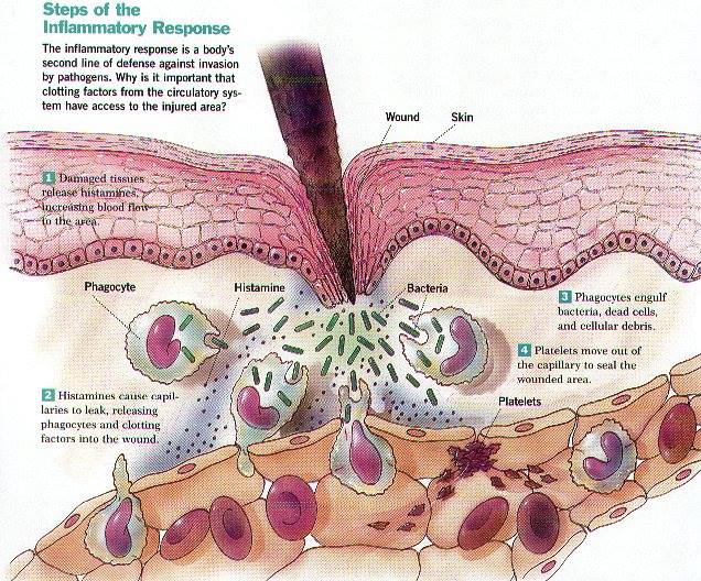 Steps-of-Inflammatory-Response